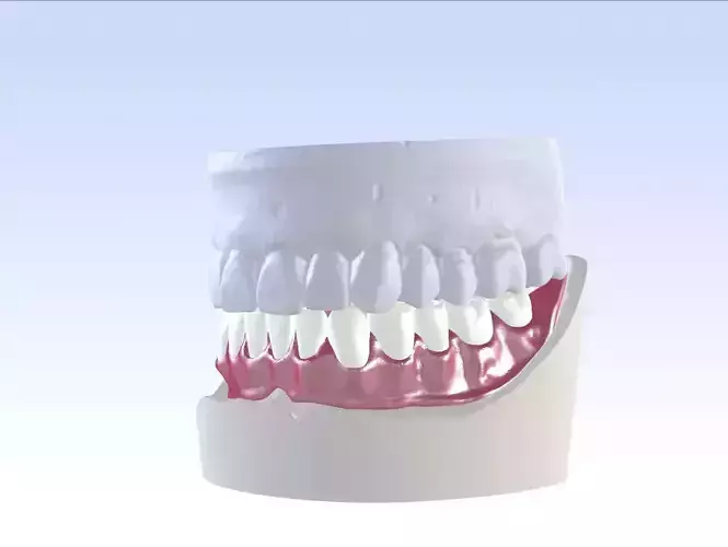 Digital Single Jaw Full Denture