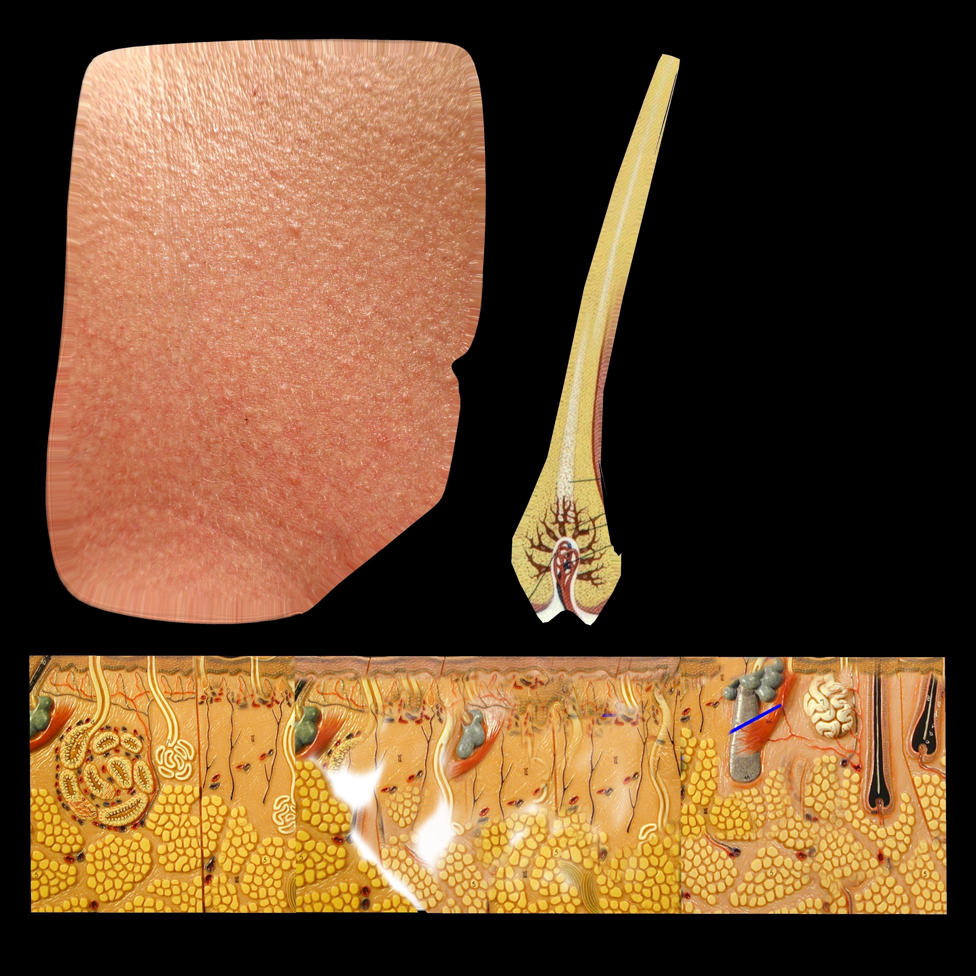 Skin Anatomy model 3D model_6
