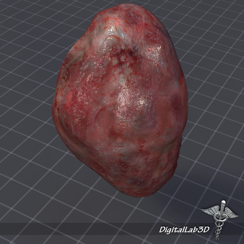 Spleen lungs 3D model_2