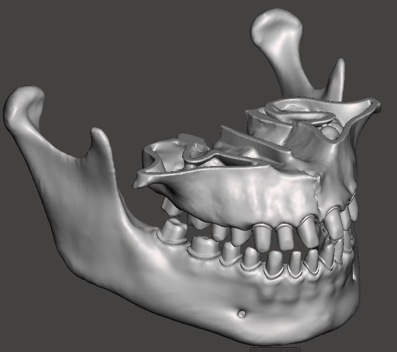 Human maxillary and mandibular jaws with typodont