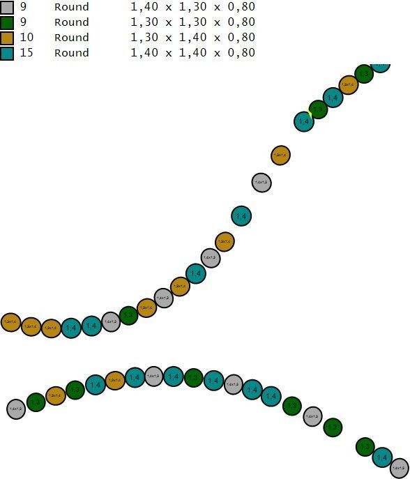 R 0002 3D print model_16