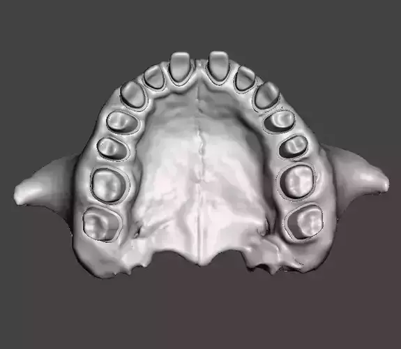 Human maxillary jaw with typodont  3D print model