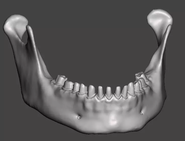 Human mandibular jaw with typodont  3D print model_0