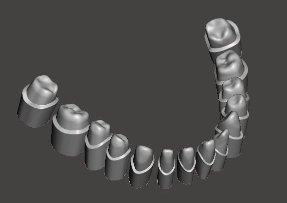 Human mandibular jaw with typodont  3D print model_2