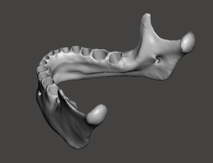 Human mandibular jaw with typodont  3D print model_1