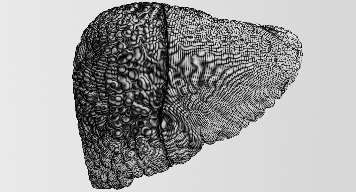 Alchoholic liver disease cirrhosis hepatitis fatty 3D model_31