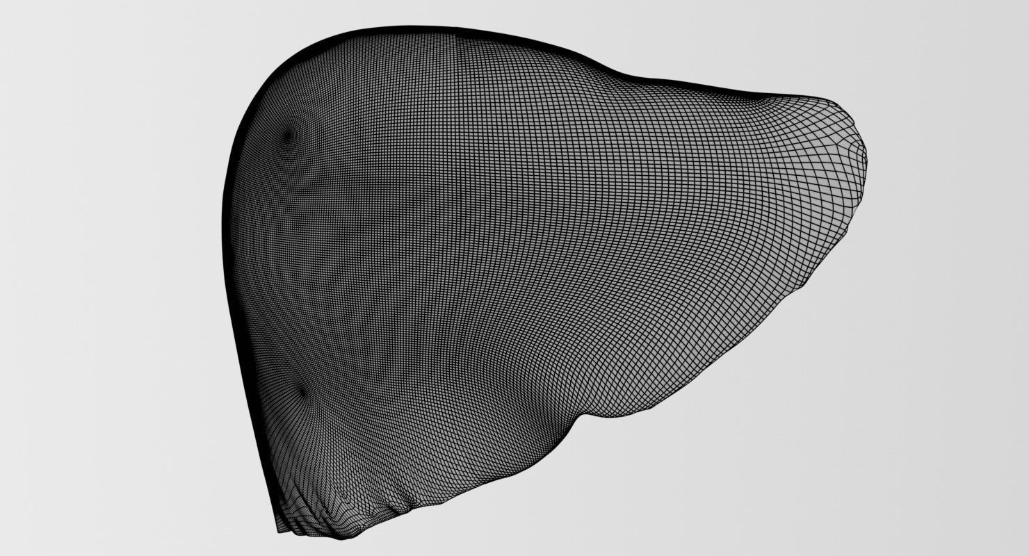 Alchoholic liver disease cirrhosis hepatitis fatty 3D model_26