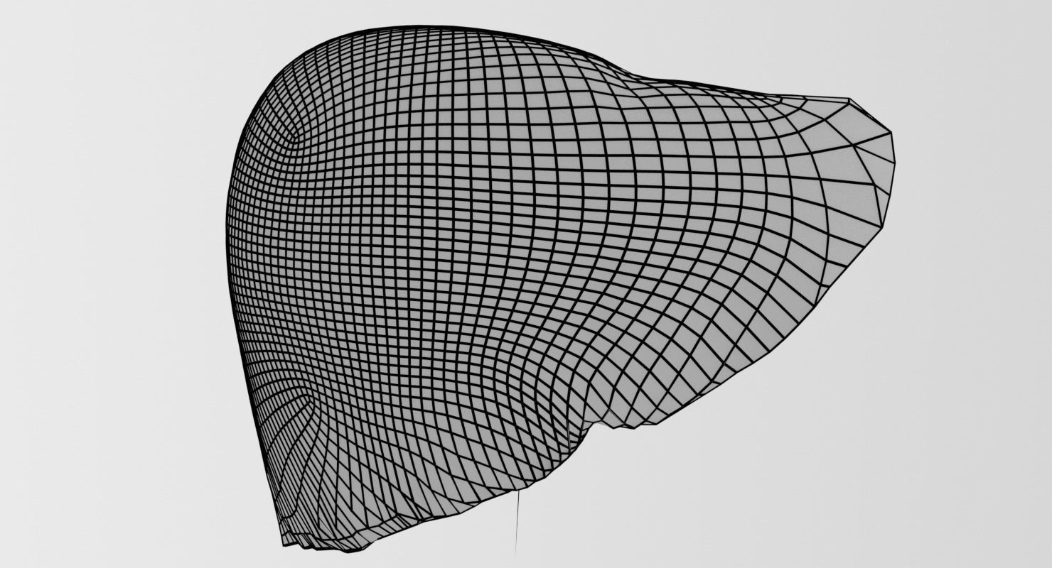 Alchoholic liver disease cirrhosis hepatitis fatty 3D model_25