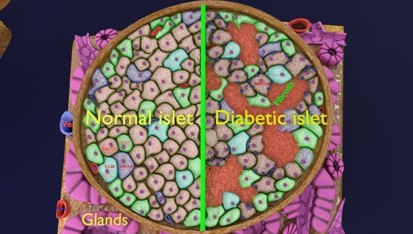 Diabetes pancreas anatomy microscopy islet beta insulin 3D model_5
