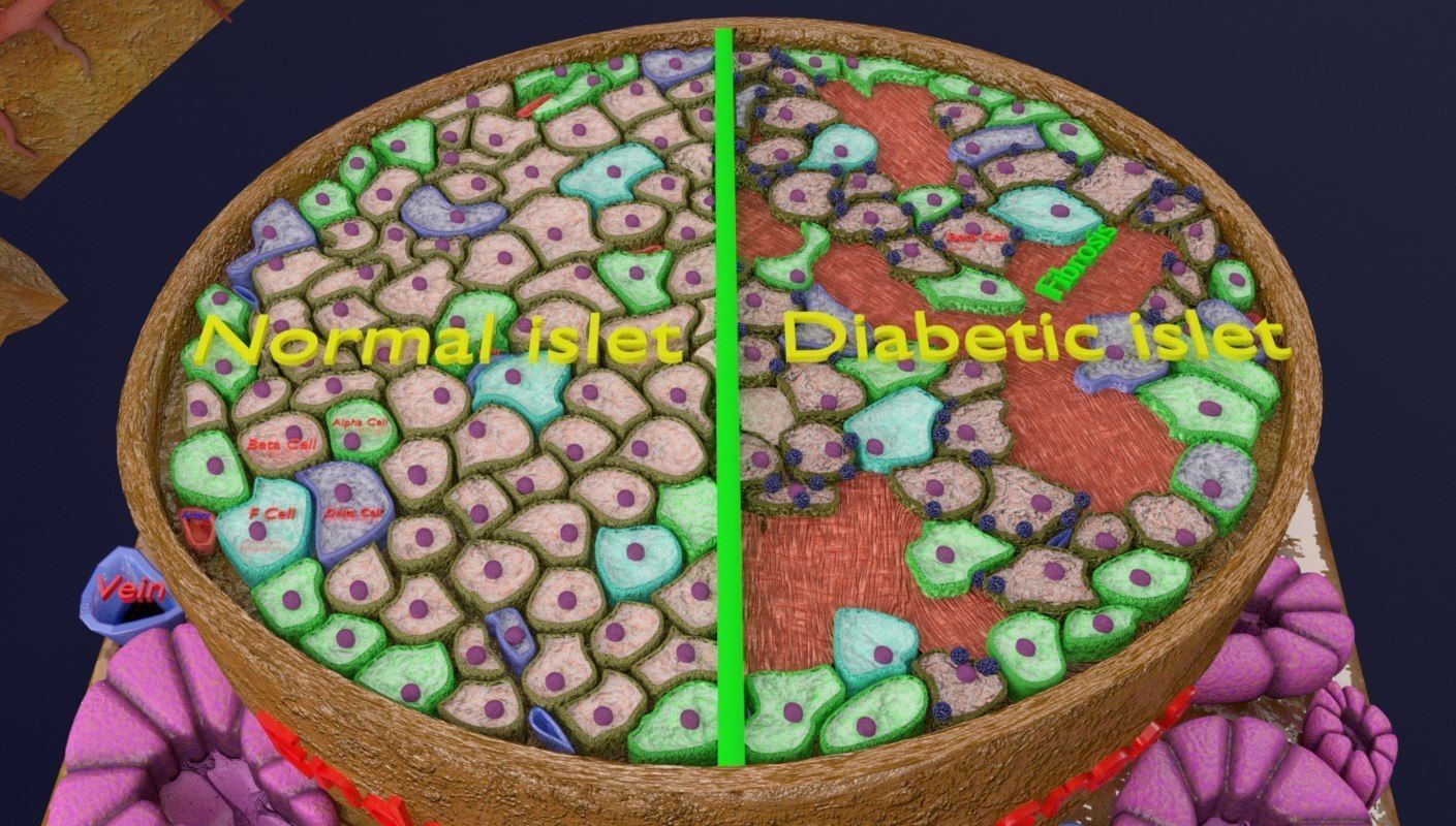 Diabetes pancreas anatomy microscopy islet beta insulin 3D model_6