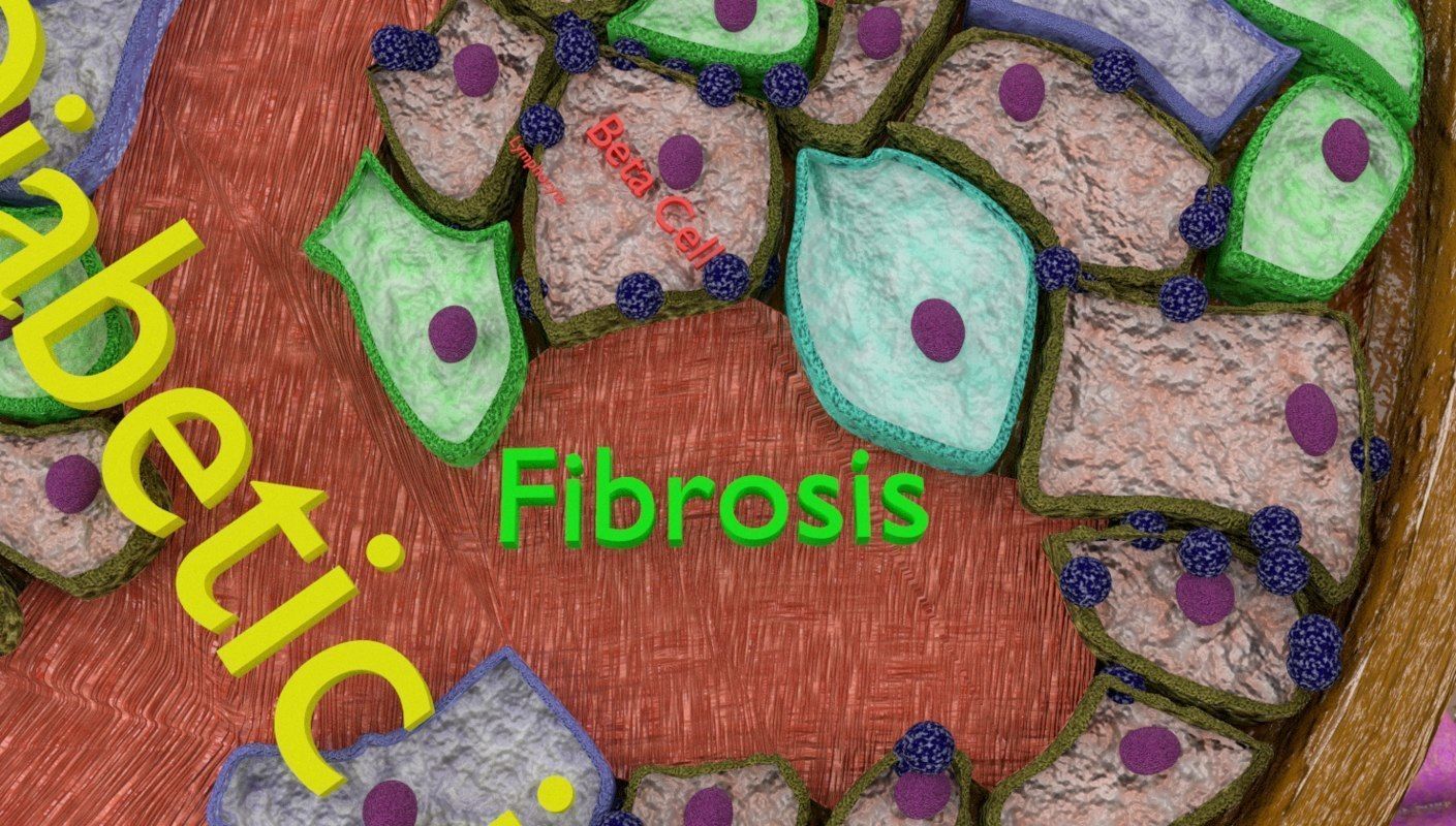 Diabetes pancreas anatomy microscopy islet beta insulin 3D model_10