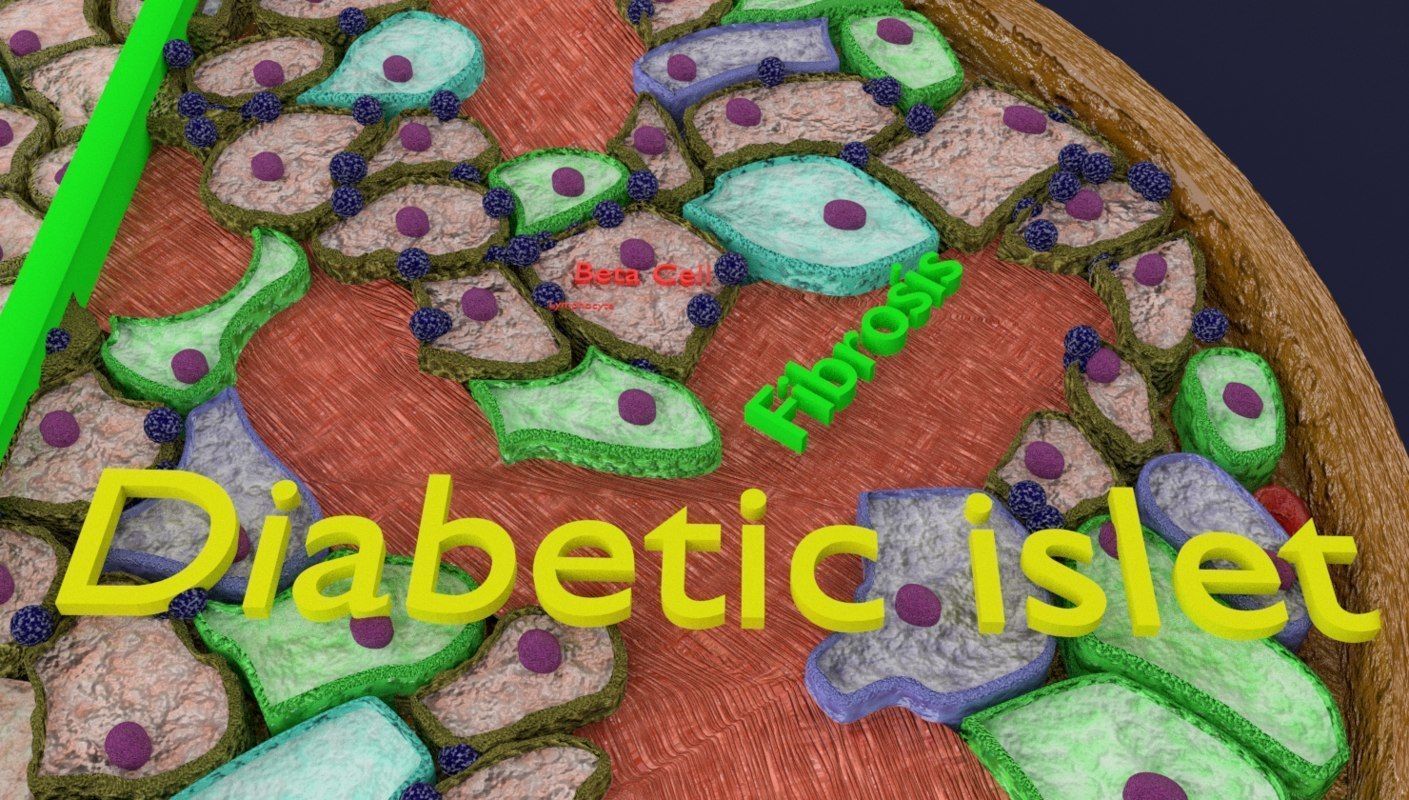 Diabetes pancreas anatomy microscopy islet beta insulin 3D model_9