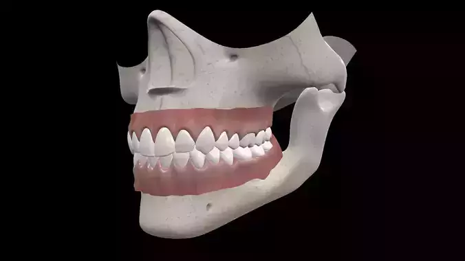 Skull human with teeth missing