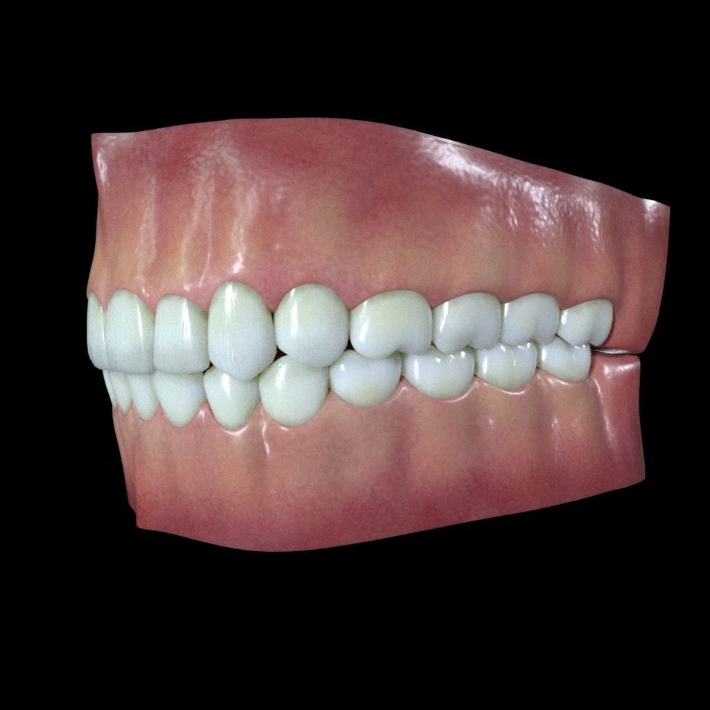 Teeth and Gums 3D model_1