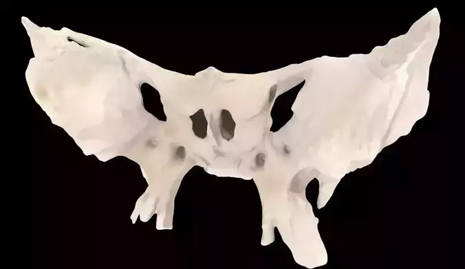Sphenoid Bone 3D Scan 