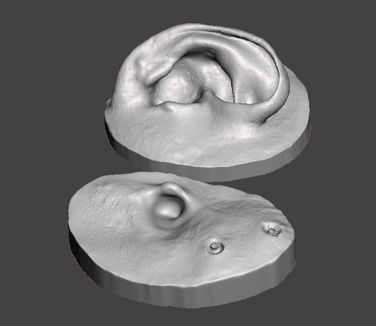 Natural human ear anatomy for attachment retained prosthesis 3D print model_2