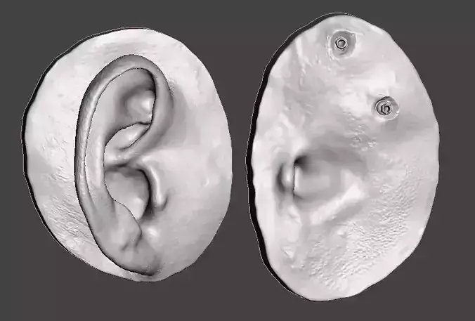 Natural human ear anatomy for attachment retained prosthesis