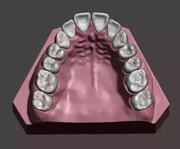 Maxillary dental model