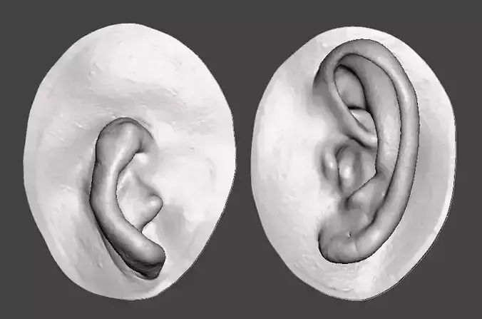 Natural ear anatomy microtia 3D print model