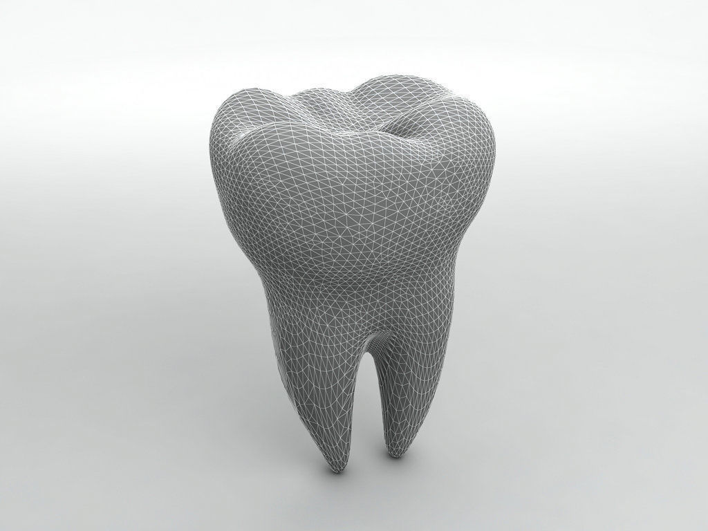 Molar Tooth 3D model_1