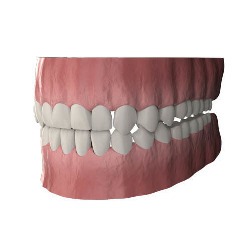 teeth human mouth with 3D model_2