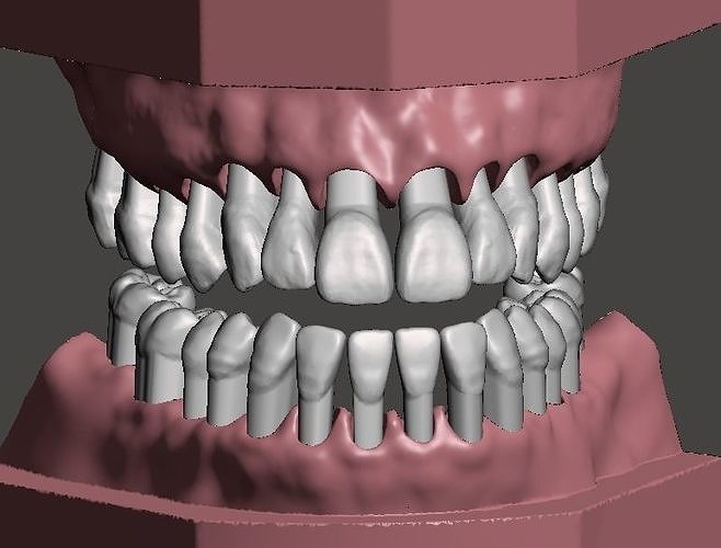 Maxillary and Mandibular dental models 3D print model