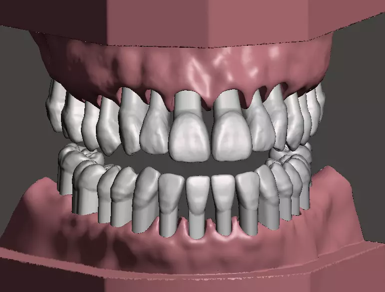 Maxillary and Mandibular dental models 3D print model_0