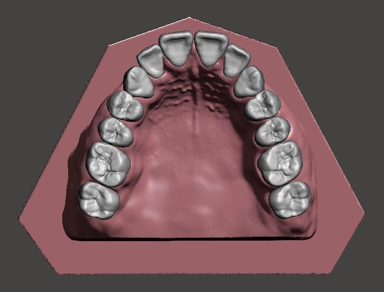 Maxillary and Mandibular dental models 3D print model_3