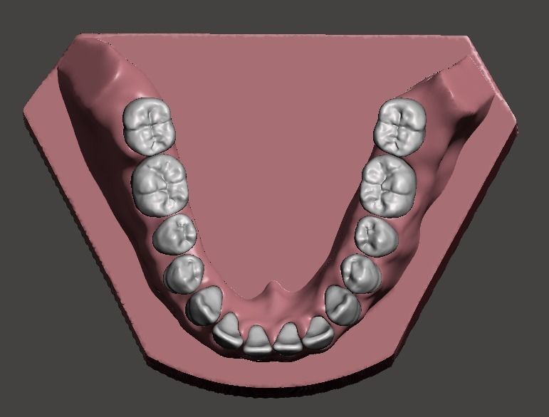 Maxillary and Mandibular dental models 3D print model_4