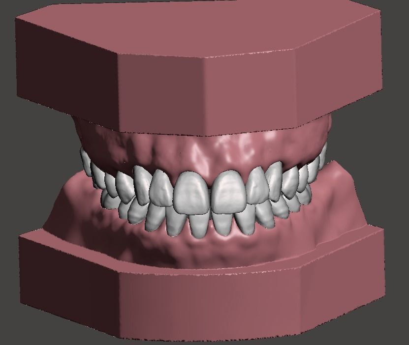 Maxillary and Mandibular dental models 3D print model_1