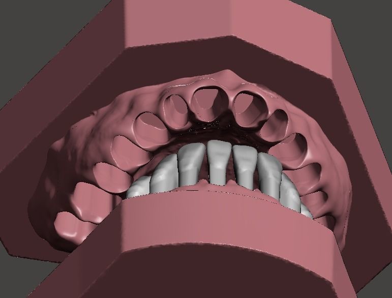Maxillary and Mandibular dental models 3D print model_5