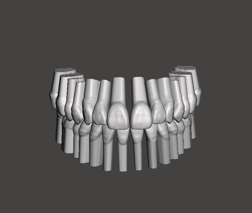 Maxillary and Mandibular dental models 3D print model_2