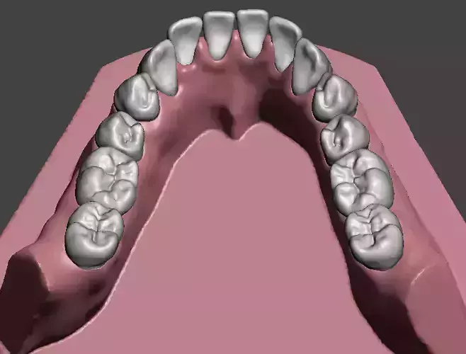 Mandibular dental model