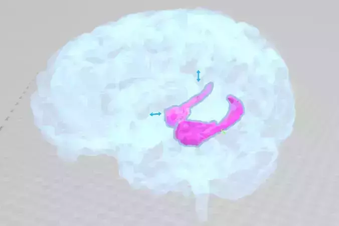 Hippocampus of Brain 3D print model