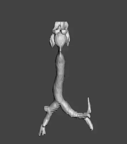 Trachea and bronchi 3D print model