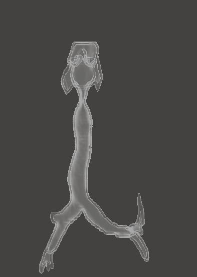 Trachea and bronchi 3D print model_3