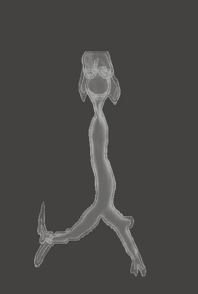 Trachea and bronchi 3D print model_4