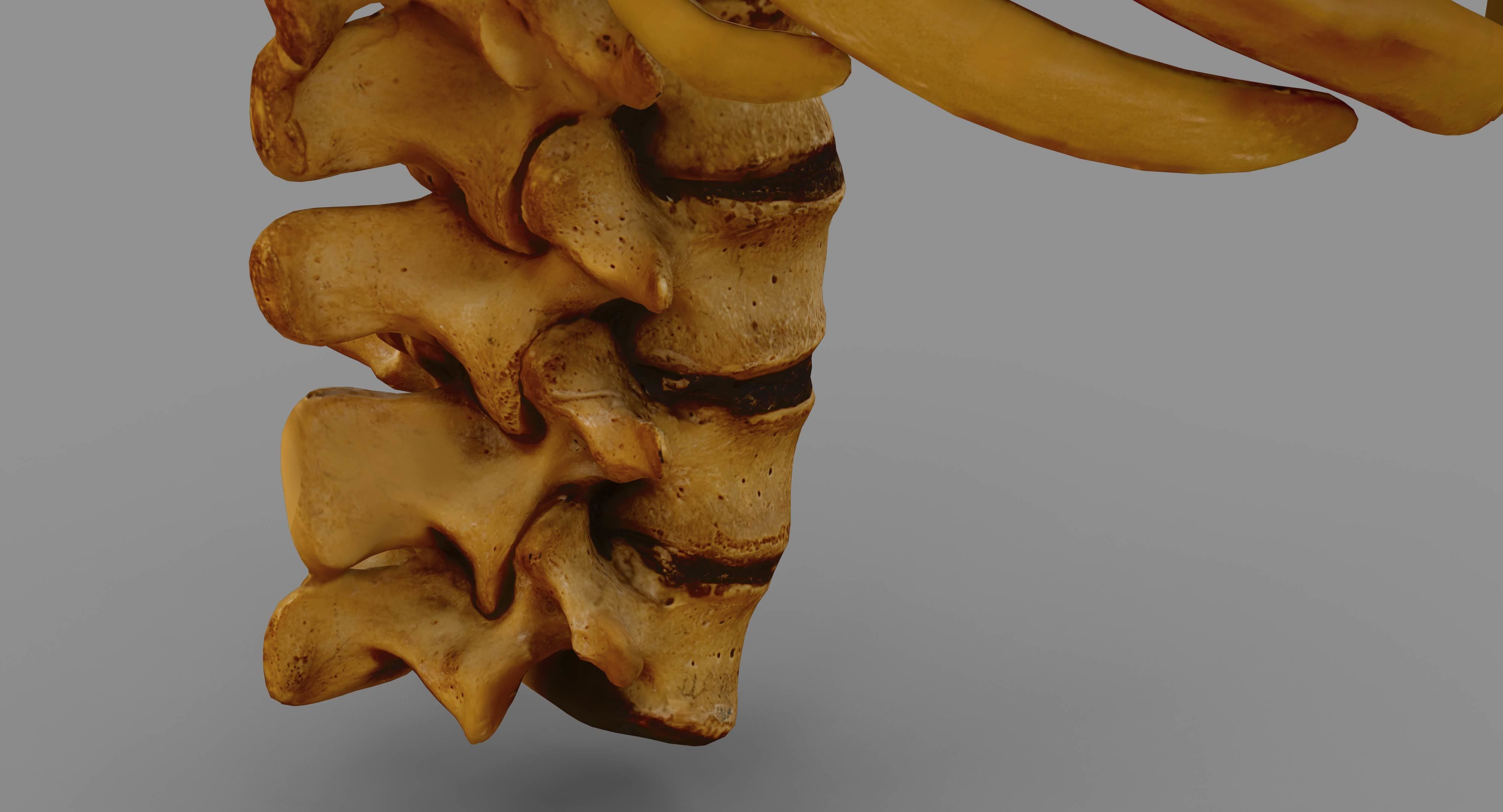 Human Spine Scanned Low-poly 3D model_42