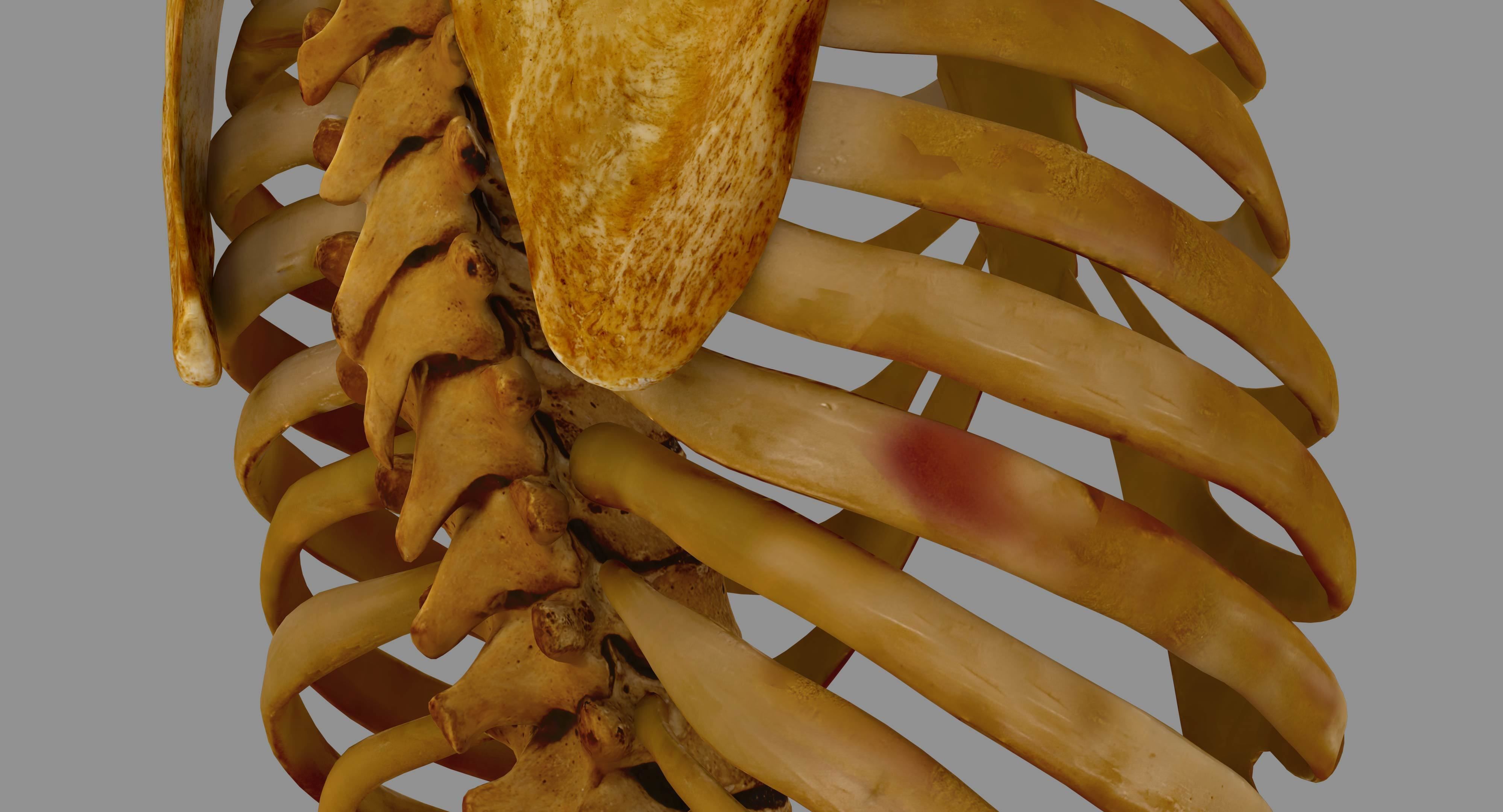 Human Spine Scanned Low-poly 3D model_38