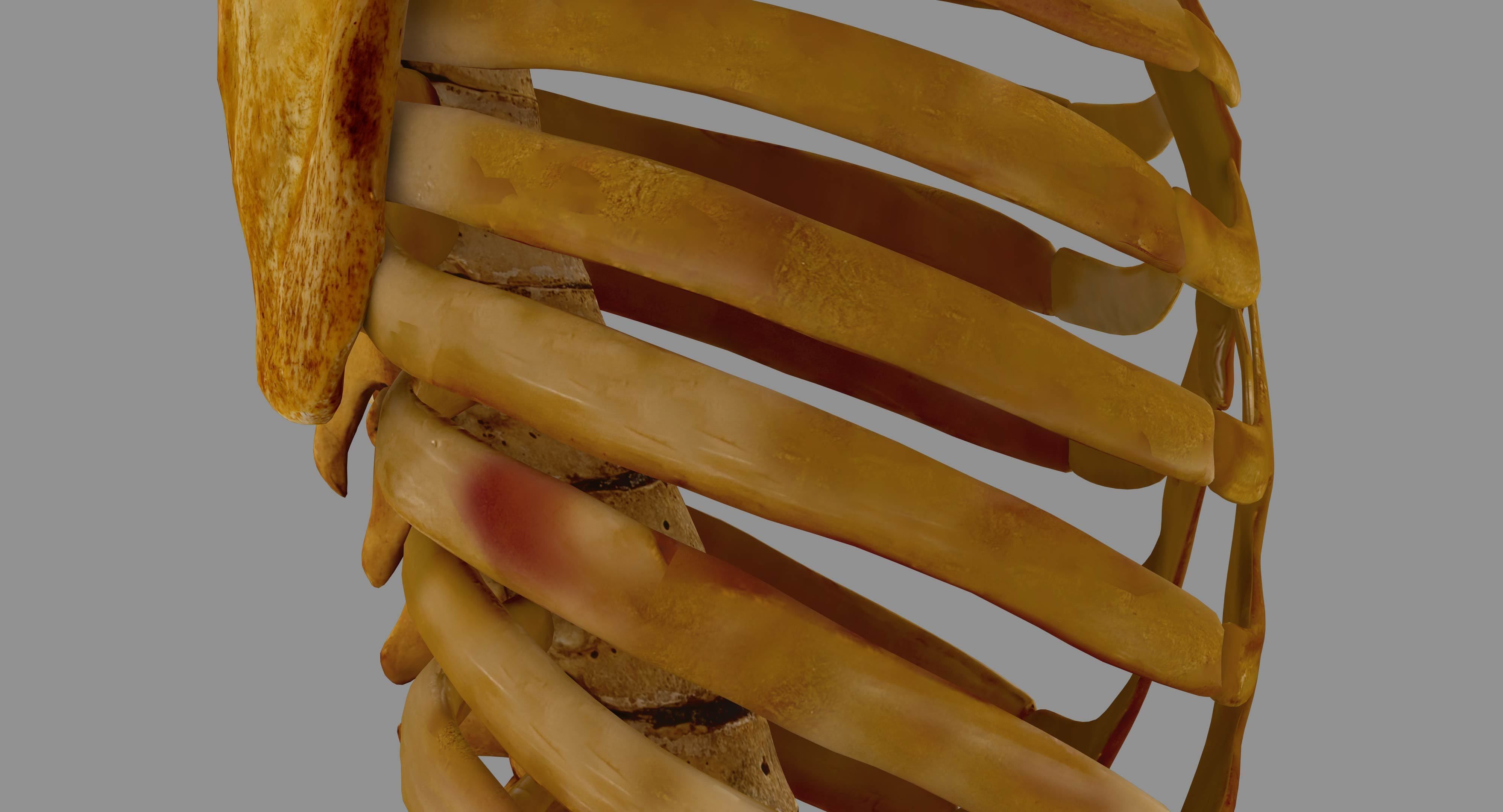 Human Spine Scanned Low-poly 3D model_28