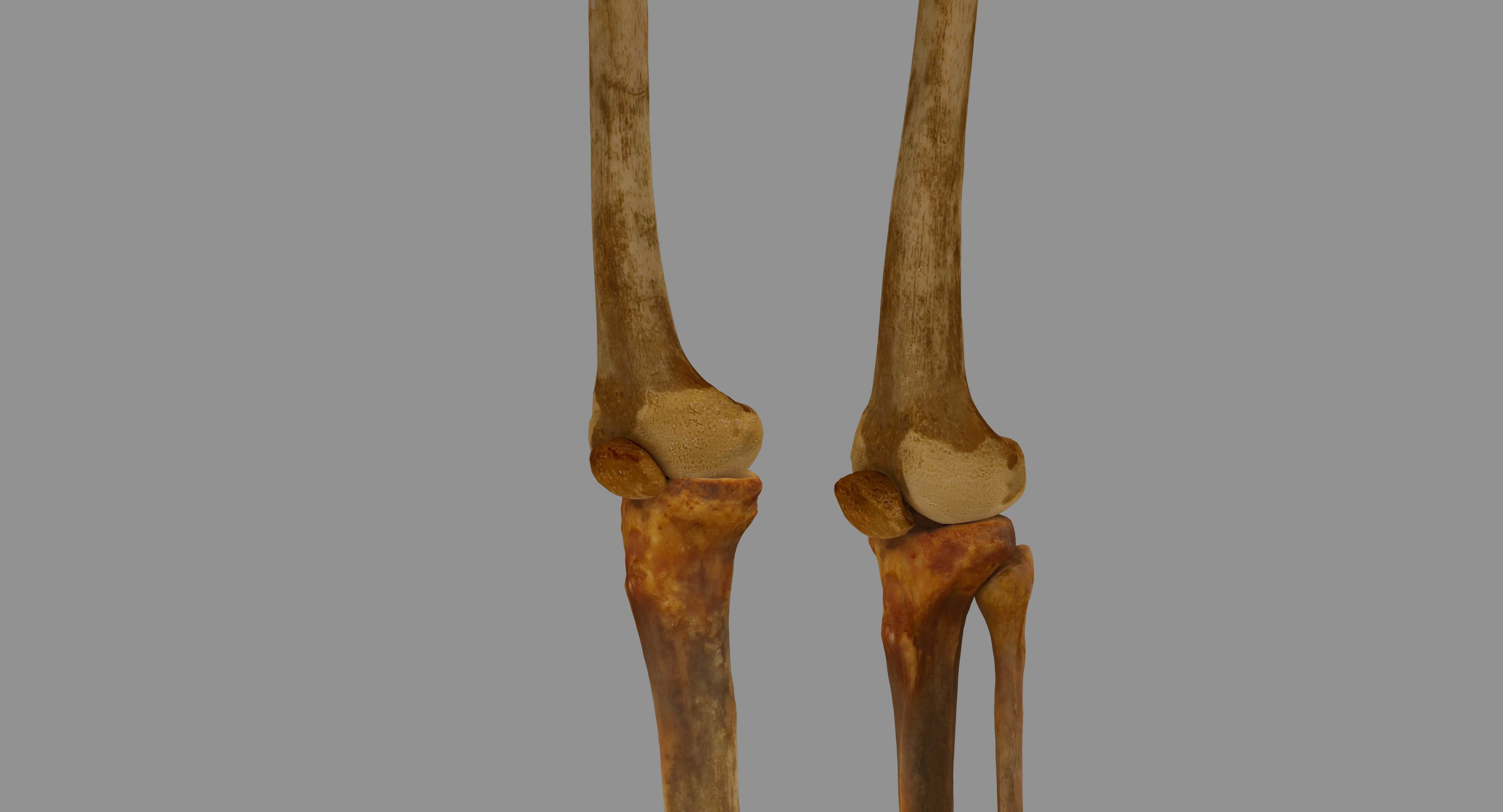 Human Skeleton Scanned Low-poly 3D model_81