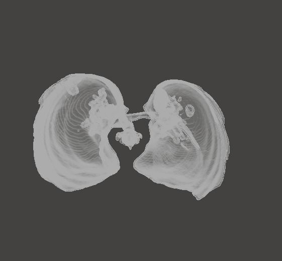 Human Respiratory System 3D print model_5
