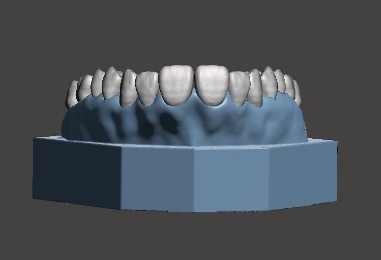 D001 Dental Sample model 3D print model_3