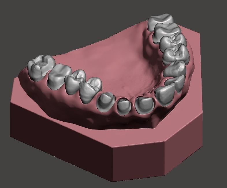 D001 Dental Sample model 3D print model_4