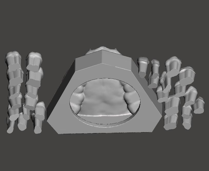 D001 Dental Sample model 3D print model_1