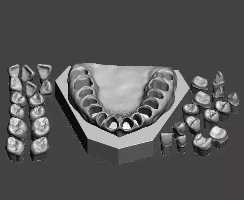 D001 Dental Sample model 3D print model_0