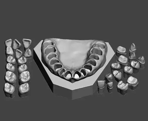 D001  Dental Sample model 3D print model
