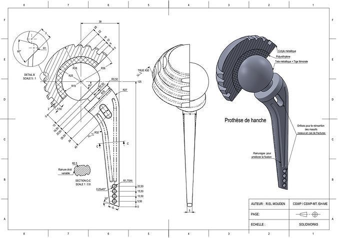 Prosthetic hip joint 3D print model