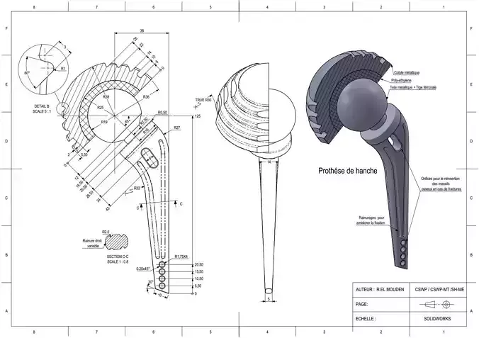 Prosthetic hip joint