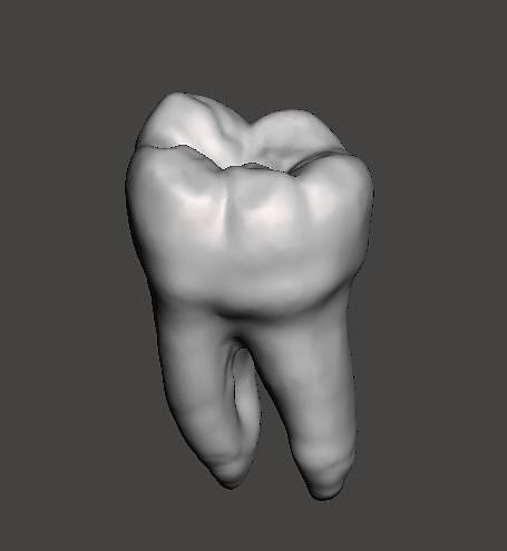 Mandibular left first molar Free 3D print model